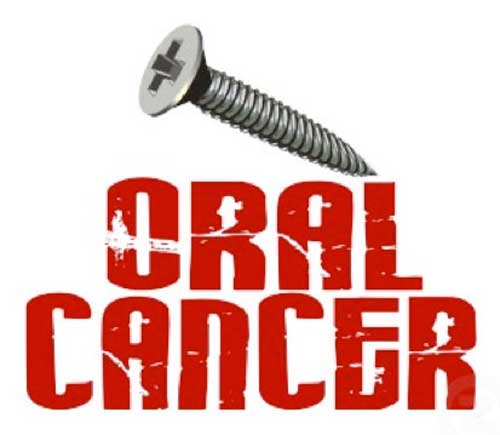 Screw Oral Cancer