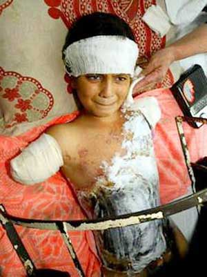 This child was brutally injured by Republican lies supported by Democrats